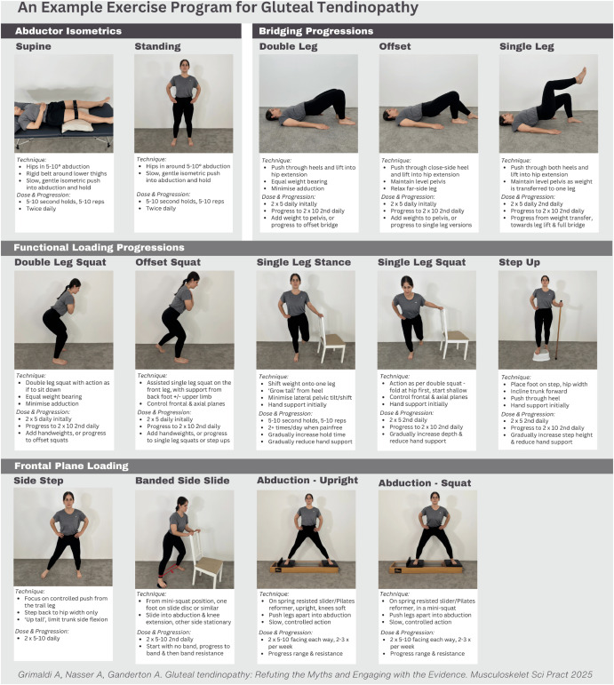 Gluteal Tendinopathy Exercises to Avoid