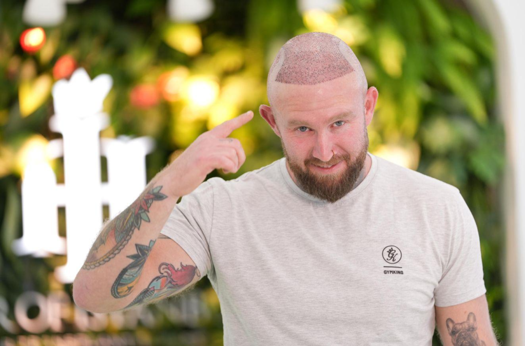 Istanbul Hair Transplant