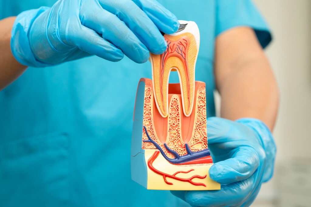 Endodontics vs Extraction: What’s Better in Singapore?