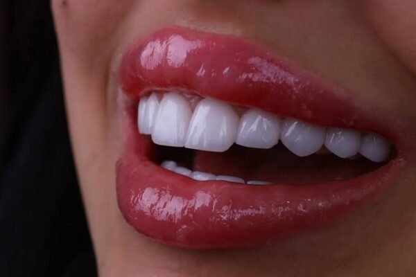 Dental Tourism in Turkey from the UK What to Check Before You Book (It's More Than a Hollywood Smile)
